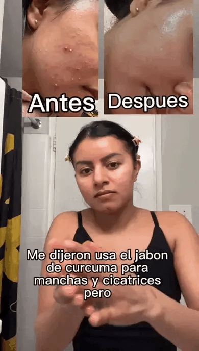 ¿Cansad@ de lidiar con manchas, acné o una piel opaca y sin vida?