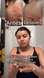 ¿Cansad@ de lidiar con manchas, acné o una piel opaca y sin vida?